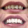 DiamondSmile™ – Zahnaufhellungsstift (1+1 GRATIS)