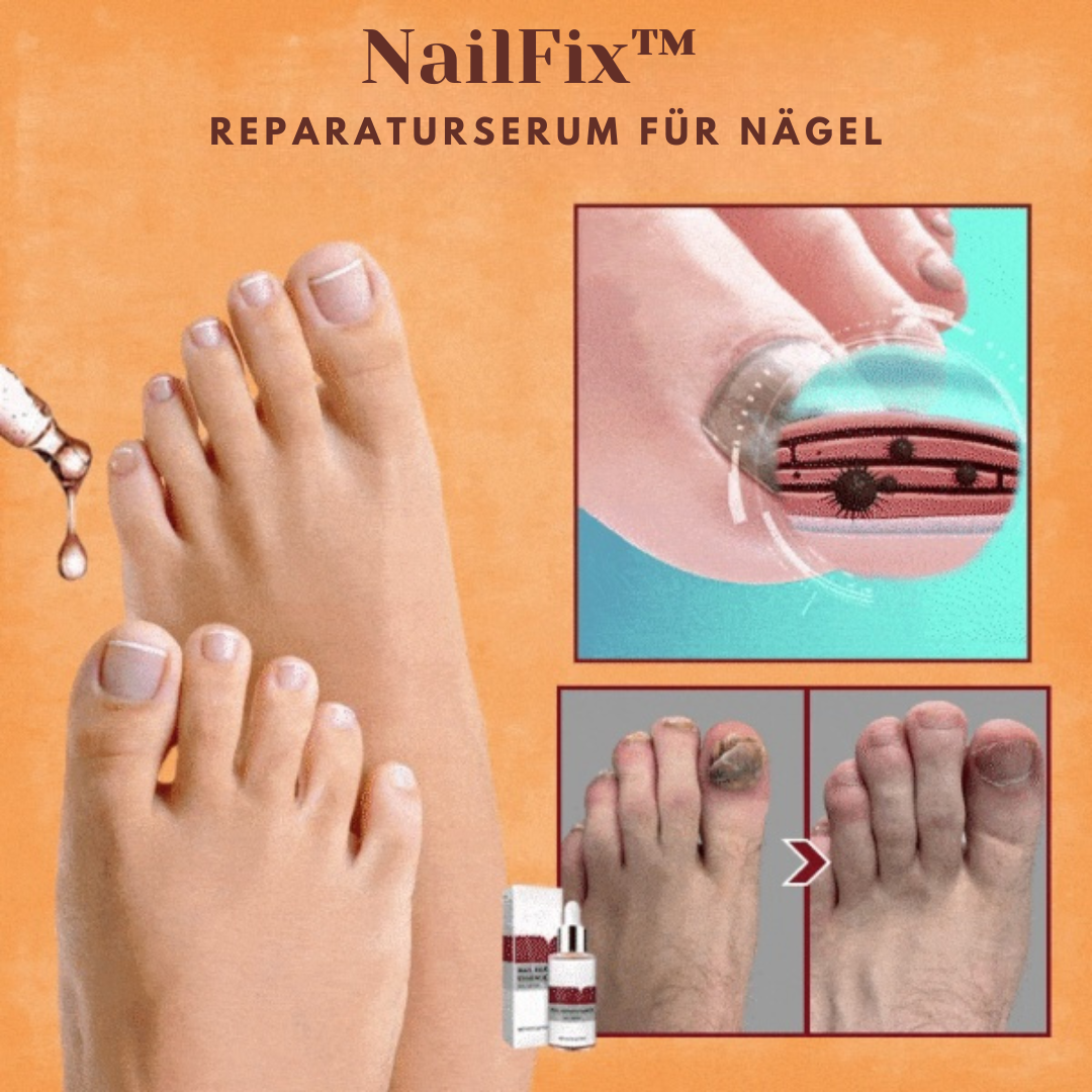 NailFix™ Reparaturserum für Nägel