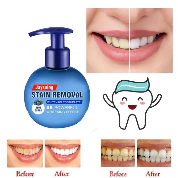Clean Tooth™ - Zahnpasta zur intensiven Fleckenentfernung